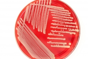 bacteria colony in petri dish