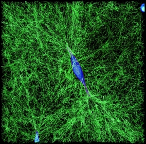 A human breast cancer cell (in blue) spreads in a 3-D collagen gel network (green). Image: Ming Guo
