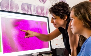 Two women look at image of a brain on a computer screen.