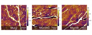 These images, taken with atomic force microscopy, show the structures of pig intestinal mucin, salivary mucin, and gastric mucin (left to right). Images courtesy of the researchers.