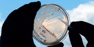 Person holds up a petri dish to the sky